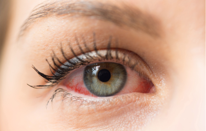 Subtle Signs Your Eyes Might Need Extra Care